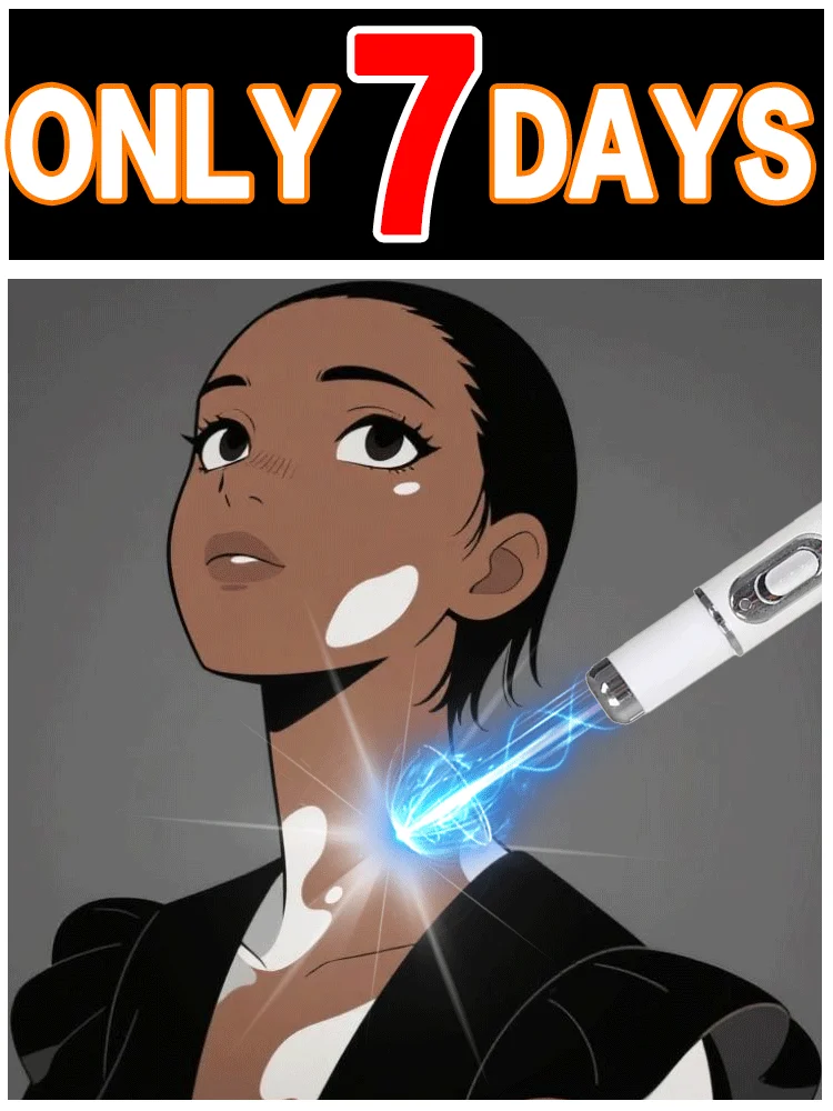 2025 Venta caliente de vacaciones Dispositivo de tratamiento de vitíligo Segunda versión mejorada Tratamiento de vitíligo Rápido