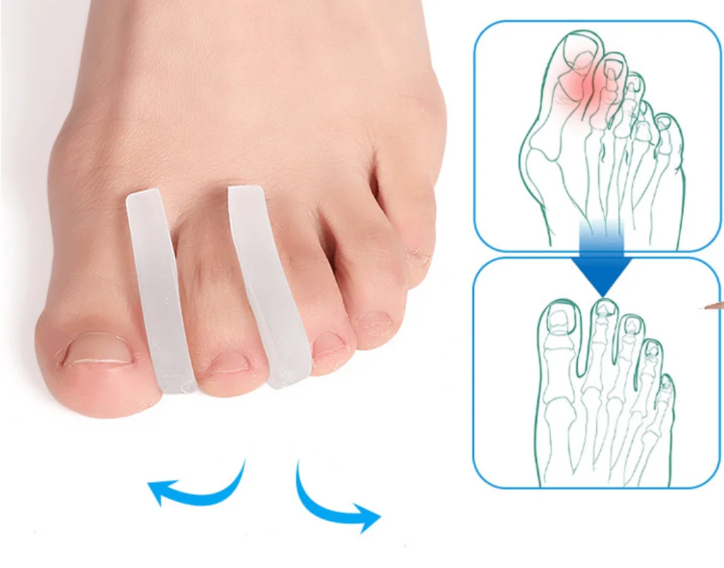 2Pcs=1Pair Gel Toe Separators for Bunion Pain Relief Toes Spacer Protector Prevent Corns Calluses Blisters and Hammertoes