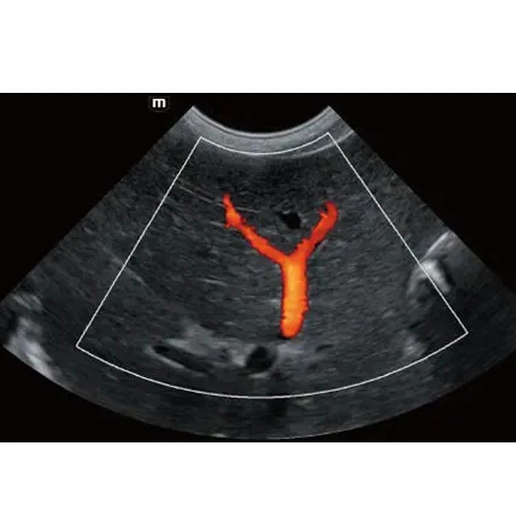 Mindray Vetus E7 Color Portable Ultrasonic Diagnostic Veterinary Ultrasound Examination Equipment