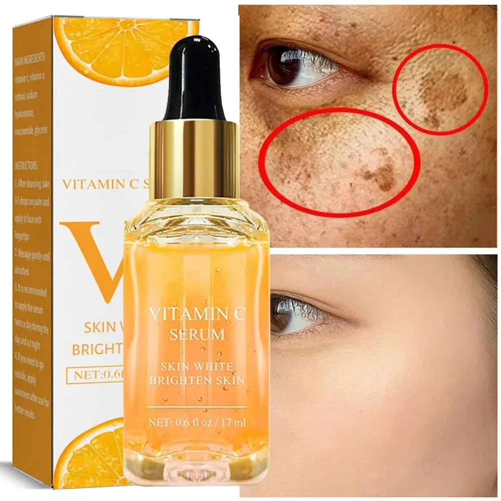 Rimuovere le macchie scure Siero viso sbiancante Lentiggine Dissolvenza Melanina Retinolo Essenza antirughe Schiarente Siero alla vitamina C Pelle