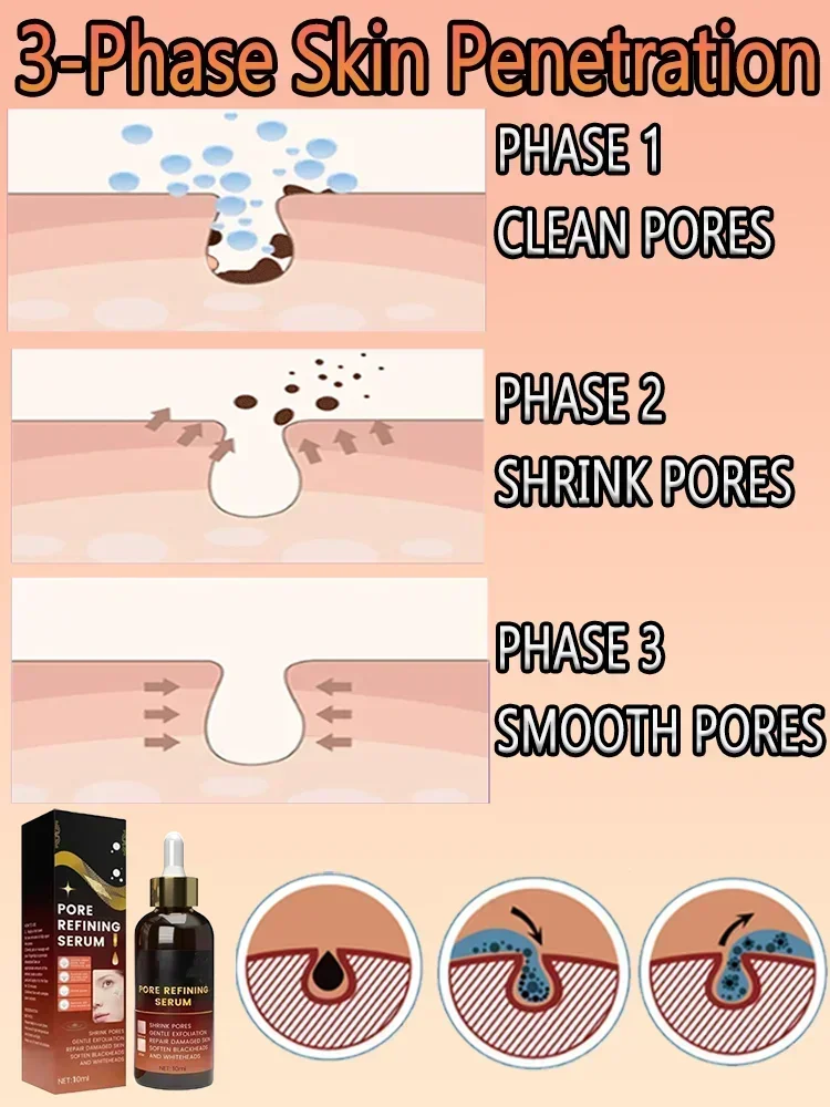 Soro de encolhimento de poros, remoção facial de poros grandes, reparação de poros faciais, minimização de essência, óleo firme, cuidados de beleza da pele