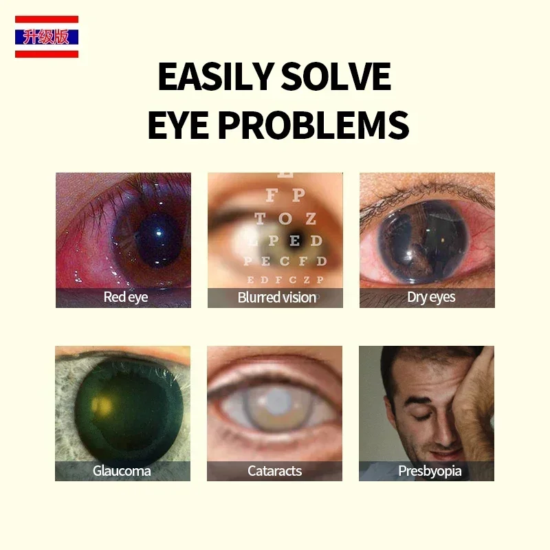 Cataract Removal Treatment Cleaner Apply To Eyes Pain Dry Itchy Fatigue Blurred Vision Eye Drops Thailand Formula Medicine