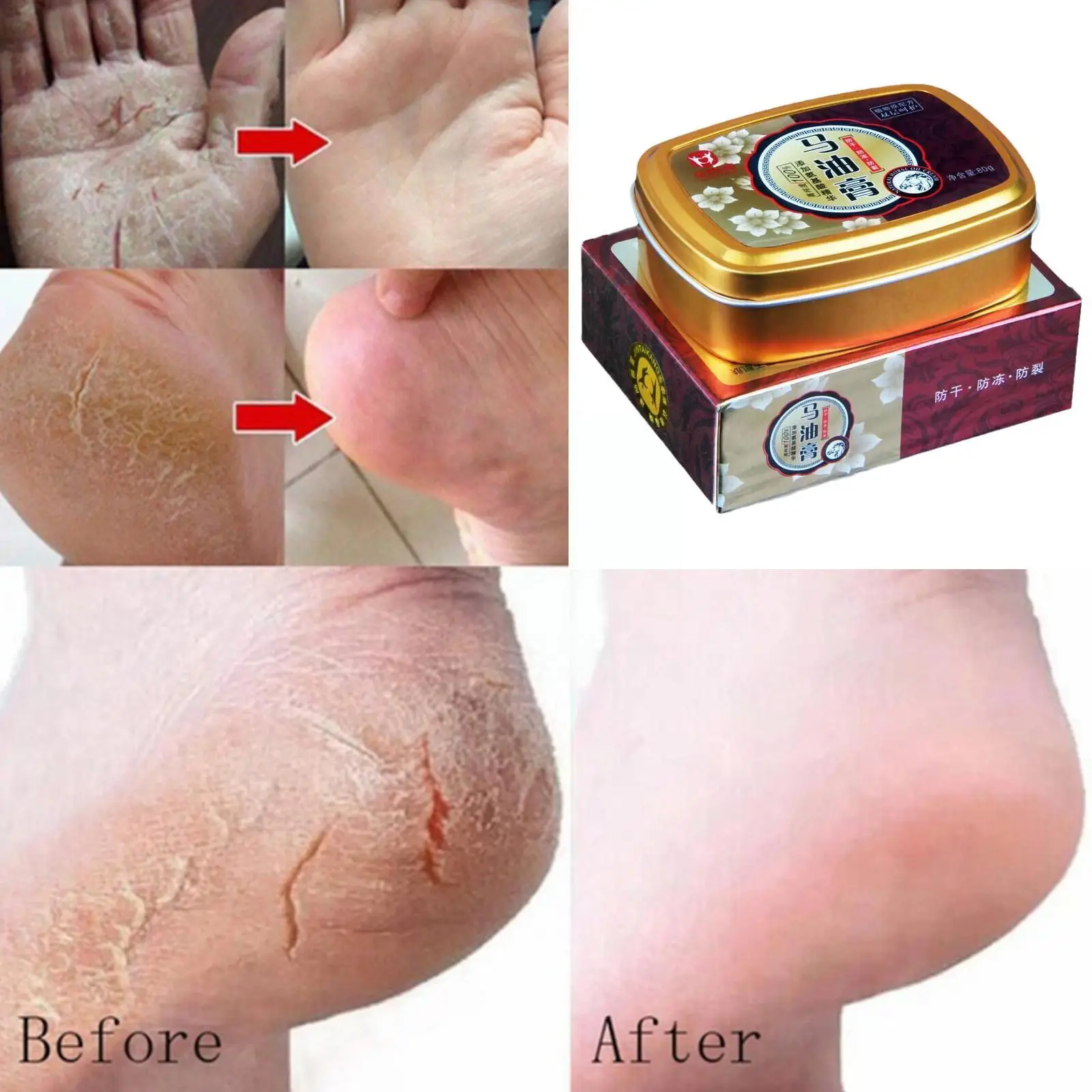 Horse Ointment 80g Oil Anti-Drying Crack Foot Cream Heel Cracked Repair Cream Removal Dead Skin Hand Feet Care for Family E9U5