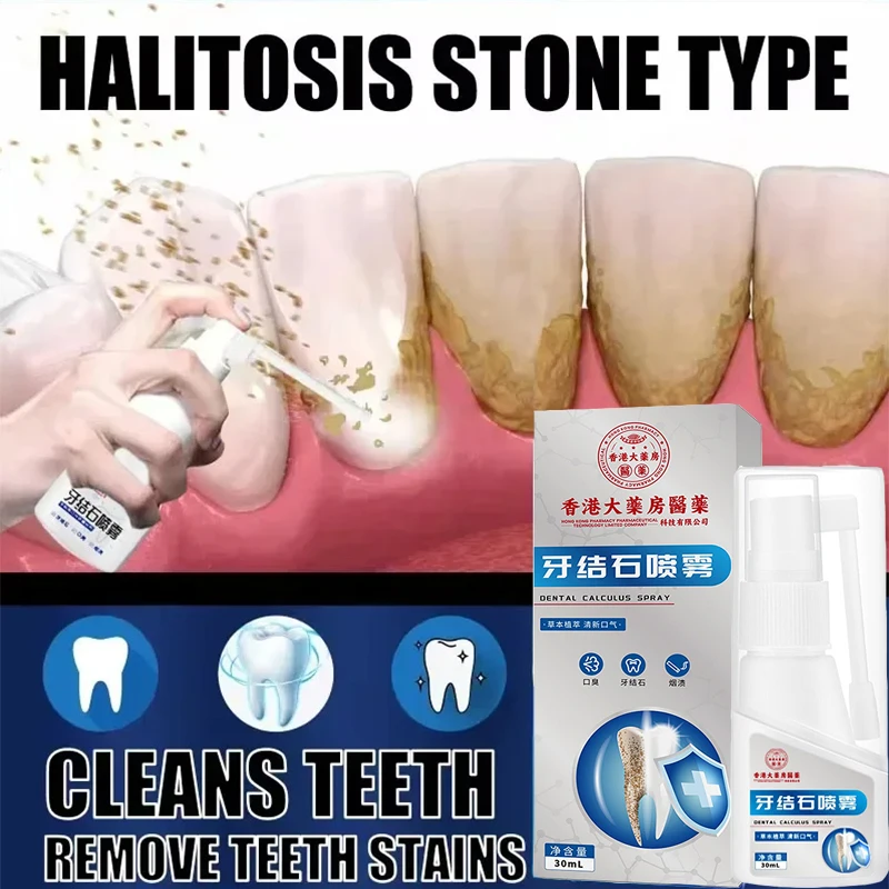 Dental Calculus Remover Teeth Whitening Spray Toothpaste cleaning Oral Hygiene Removal Halitosis Plaque Stains Fresh Breath Care