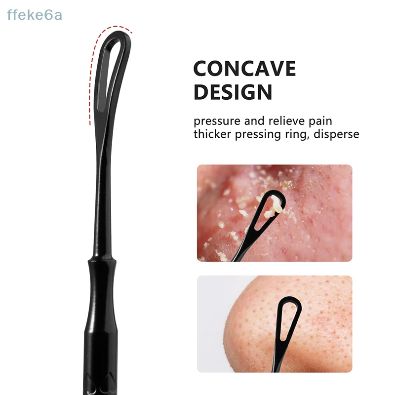 Herramienta Popper para espinillas 2 en 1, eliminador de espinillas, tratamiento para eliminar agujas de acné, Extractor de imperfecciones de cara y nariz