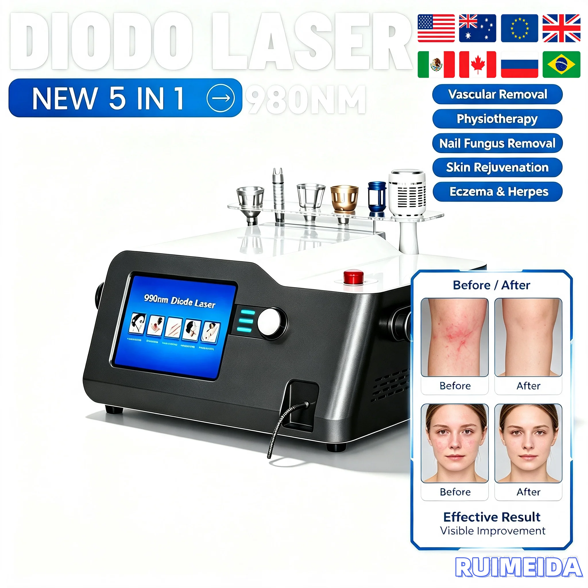 Diode Lase 980nm 5in1 Blood Vessels Machine Nail Fungus Removal Eczema Herpes 6in1 Fiber Optic Lipolysis Skin Rejuvenation CE