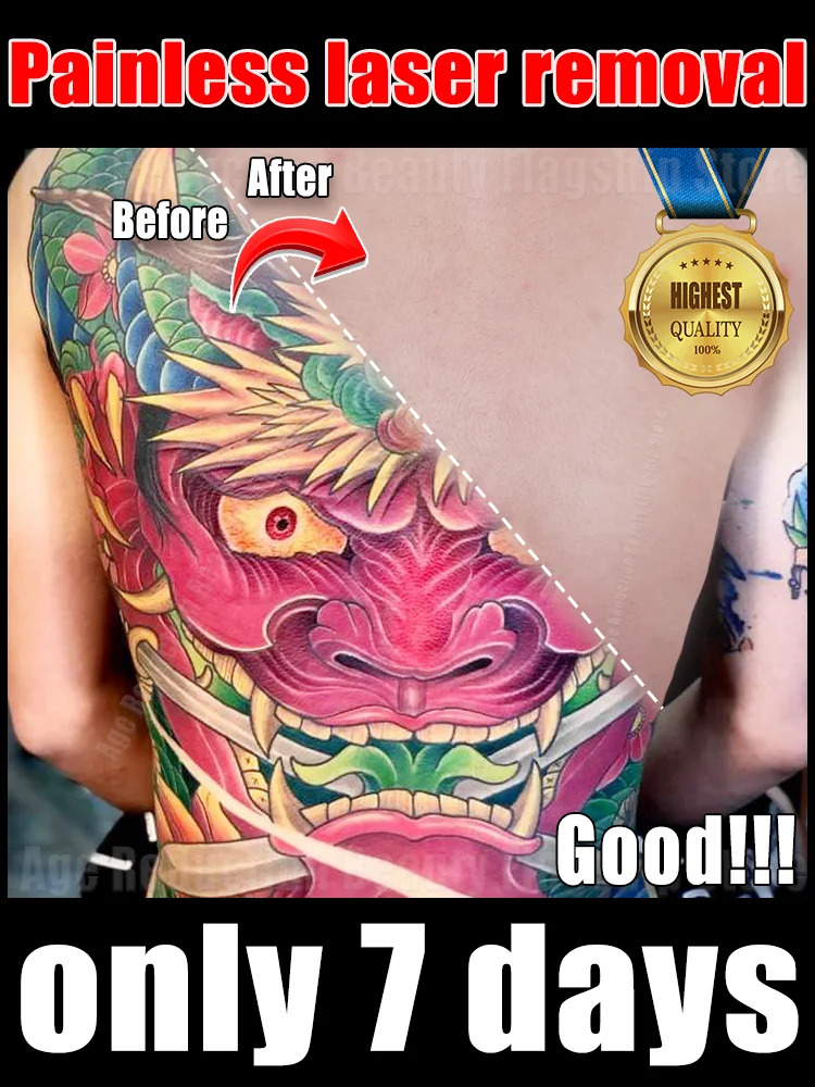 

Hot-selling products in 2025:Pᴀɪɴʟᴇss ᴛᴀᴛᴛᴏᴏ ʀᴇᴍᴏᴠᴀʟ ʟᴀsᴇʀ ᴘᴇɴ,ʙʟᴜᴇ ʟᴀsᴇʀ ᴜᴘɢʀᴀᴅᴇᴅ ᴛᴏ ᴛʜᴇ sᴇᴄᴏɴᴅ ɢᴇɴᴇʀᴀᴛɪᴏɴ