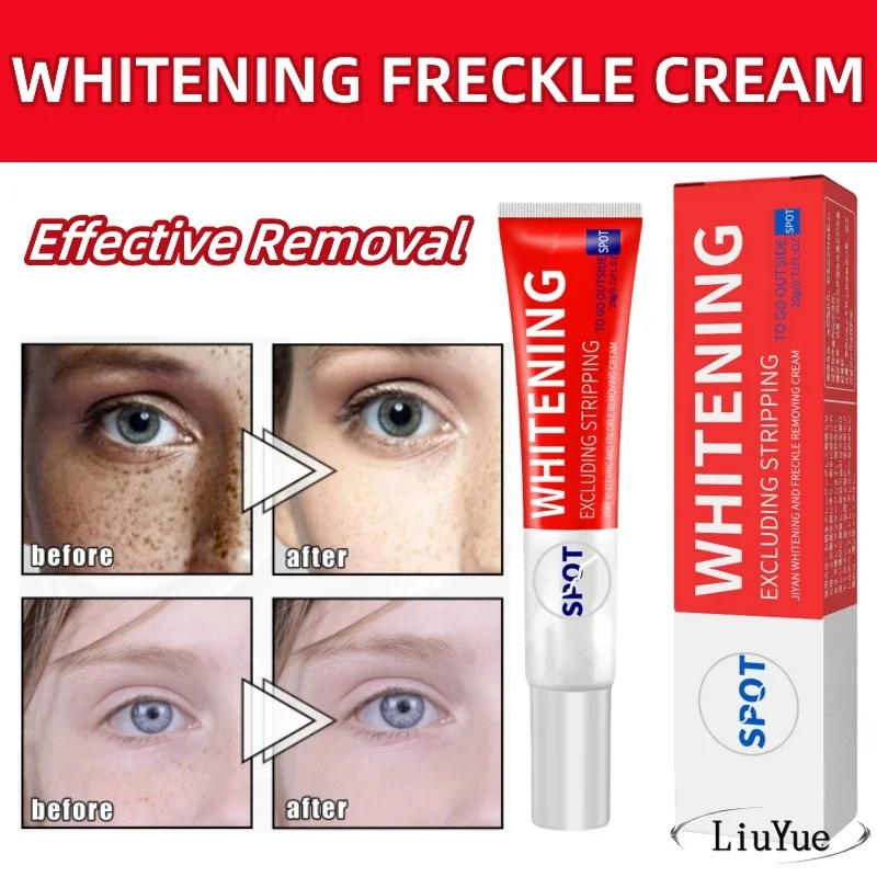 

Niacinamide Melasma Brightening Cream Reduce Melanin Brighten Products Lighten Dark Skin Fade Fine Face Lines Vitamin E Cream