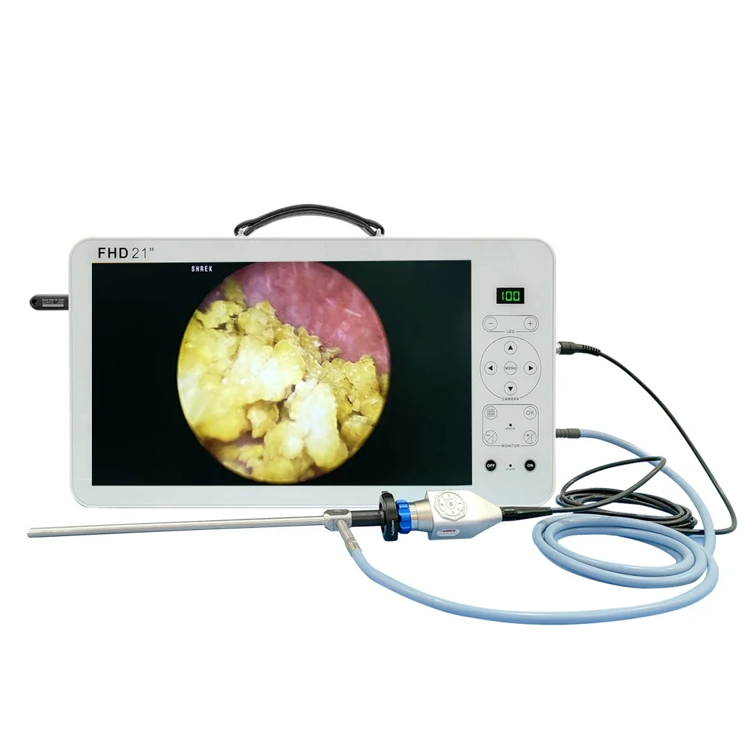 21 Inch Urology Portable Cystoscope Nephroscope Endoscope System