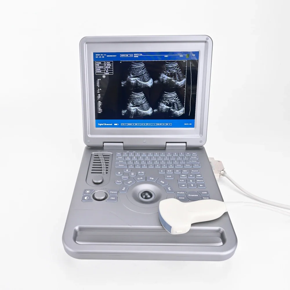 

Handheld 12 Inch White and Black Ultrasound Machine Device Ultrasound Scanner System With Convex Probe for Diagnosis
