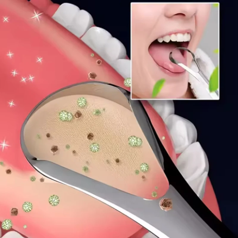 #3 Tongue Scrapers Comparison Guide