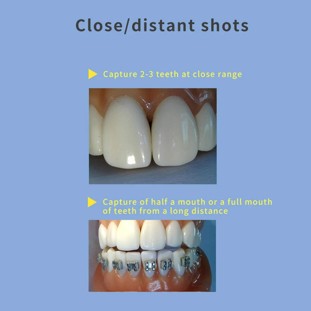 4K HD Dental Endoscope Dentistry Intraoral Camera USB Intra Oral Camera Auto Focus 8 LED tooth Camera For Windows PC Computer