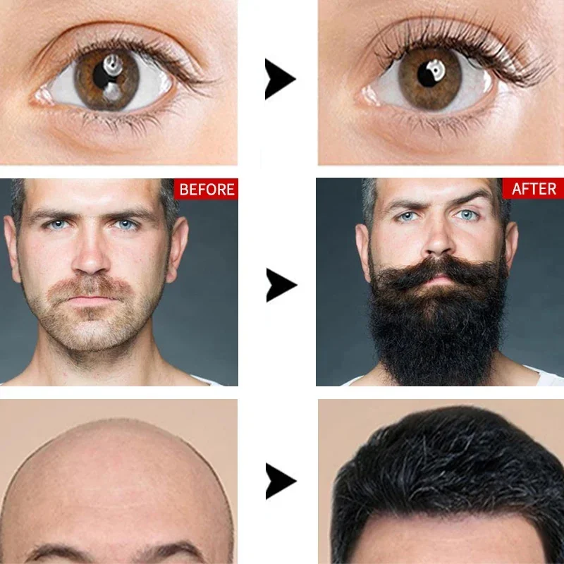 速いまつげの成長美容液製品 まつげ 眉毛エンハンサー より豊かで太いまつげのトリートメント まつげの長さを伸ばす ラッシュリフト アイケア