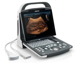 Portable Medical ultrasound instruments Human use Mindray DP10  Black and White  ultrasound machine price  veterinary Scanner