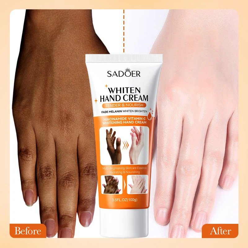 Dark Knuckles Hand Cream, Clareamento Rápido, Anti Cracking, Corretores de Pigmentação para Pele Negra, Removedor de Manchas Intenso