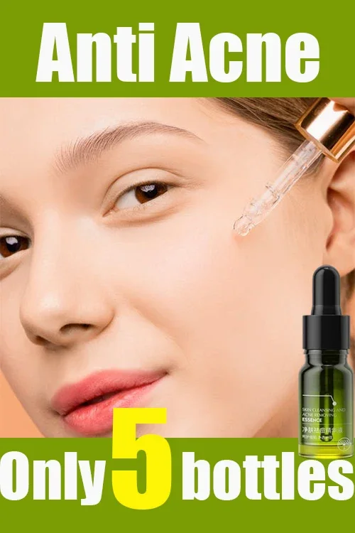 Anti-Acne Essence Deep Cleaning Acne Pimple Treatment Salicylic Oil Improve Acne Control Moisturizer Skin Care Gentle Products