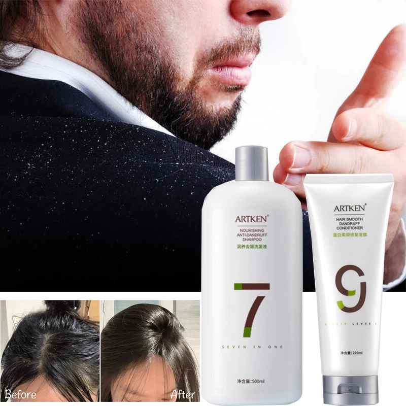 

Anti-dandruff anti-itch shampoo set refreshing shampoo degreasing softening conditioner hair mask Hair care