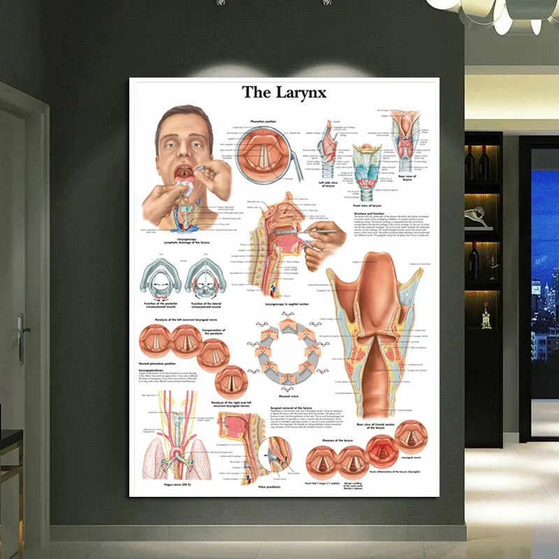 Stomatology Canvas Print Anatomical Charts Larynx Chart Pathology Wall Poster Pictures For Medical Education Office Home Decor