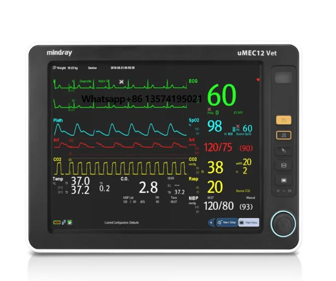 

Mindray UMEC12 Multi-Parameter with 2500mAh Li-ion Battery ECG Resp UMEC12 with SpO2