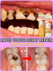 Clarear Reparazione De Creme Dentale, restaurazione Dente