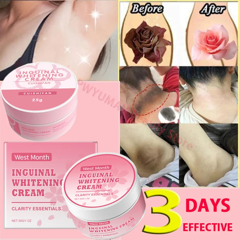 

Отбеливающий ниацинамидный осветляющий крем для интимных частей, отбеливающий крем для подмышек, коленей, осветляющий внутреннюю часть бедра, корейские средства по уходу за кожей