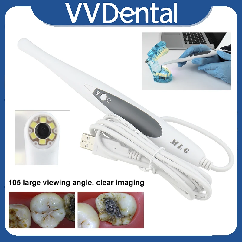 Dental Intraoral Camera Sensor 1/4 CMOS 13MP with 6 LED Light Oral Examination Camera Endoscope Automatic Focusing Dental Tools