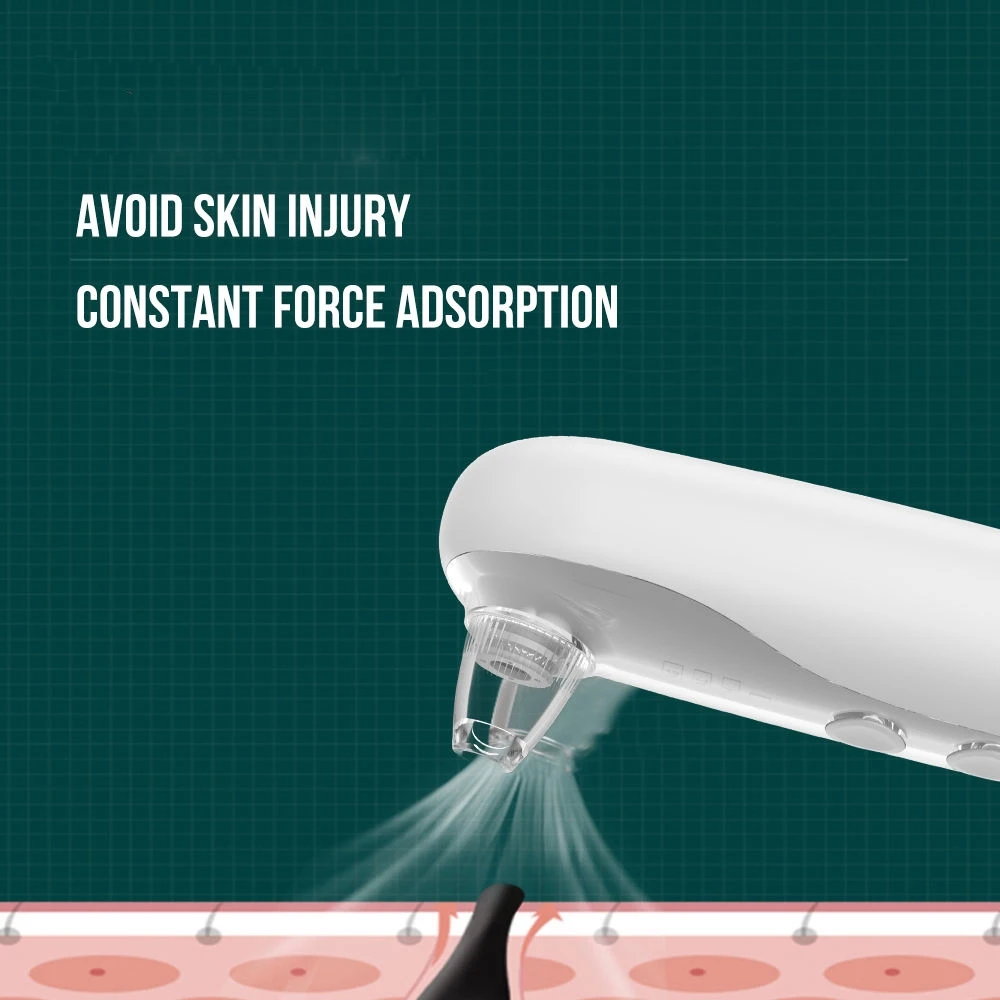 مصاصة الرؤوس السوداء الكهربائية، مزيل الرؤوس السوداء وحب الشباب، مستخرج الوجه الساخن، مزيل الرؤوس السوداء البصرية، آلة تنظيف عميق للوجه #5