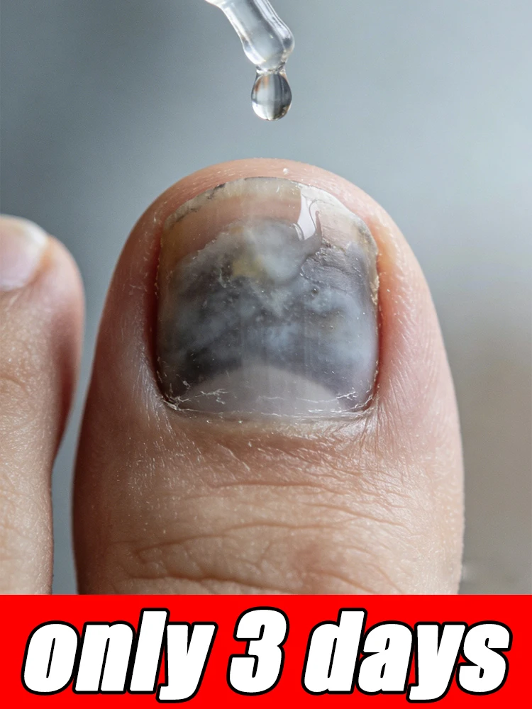 

Быстрые решения для 2026 года: Новые бестселлеры – щетки для чистки ногтей и пластиковые пылесосы