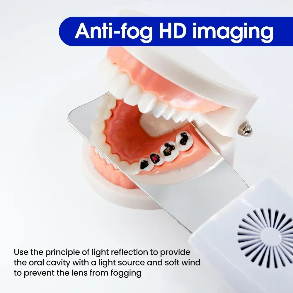 Orthodontic dental supplies including anti-fog mirror. Buccal occlusal lingual. Automatic defog for oral photography reflector.