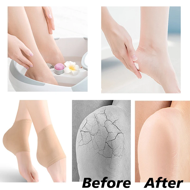 4/2Pc Gel Moisturizing Heel Socks Spa Sock For Foot Care Gel Heel Socks For Dry Feet Dry Cracked Skin Gel Heel Repair Sock Tools