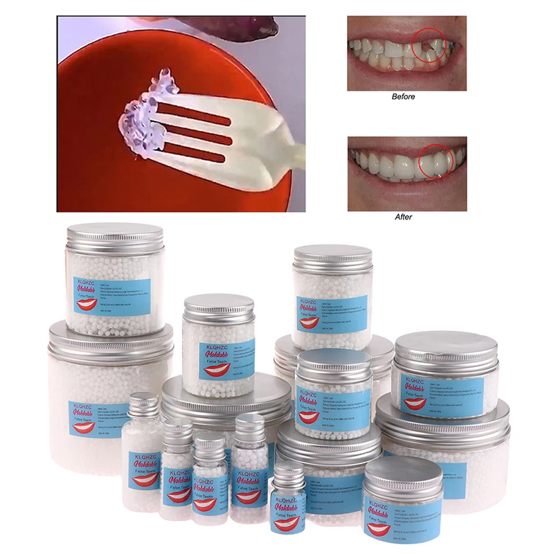 Pegamento de reparación de dientes de resina, relleno de huecos de dientes temporales sólidos, pegamento Falseteeth, suministros dentales de