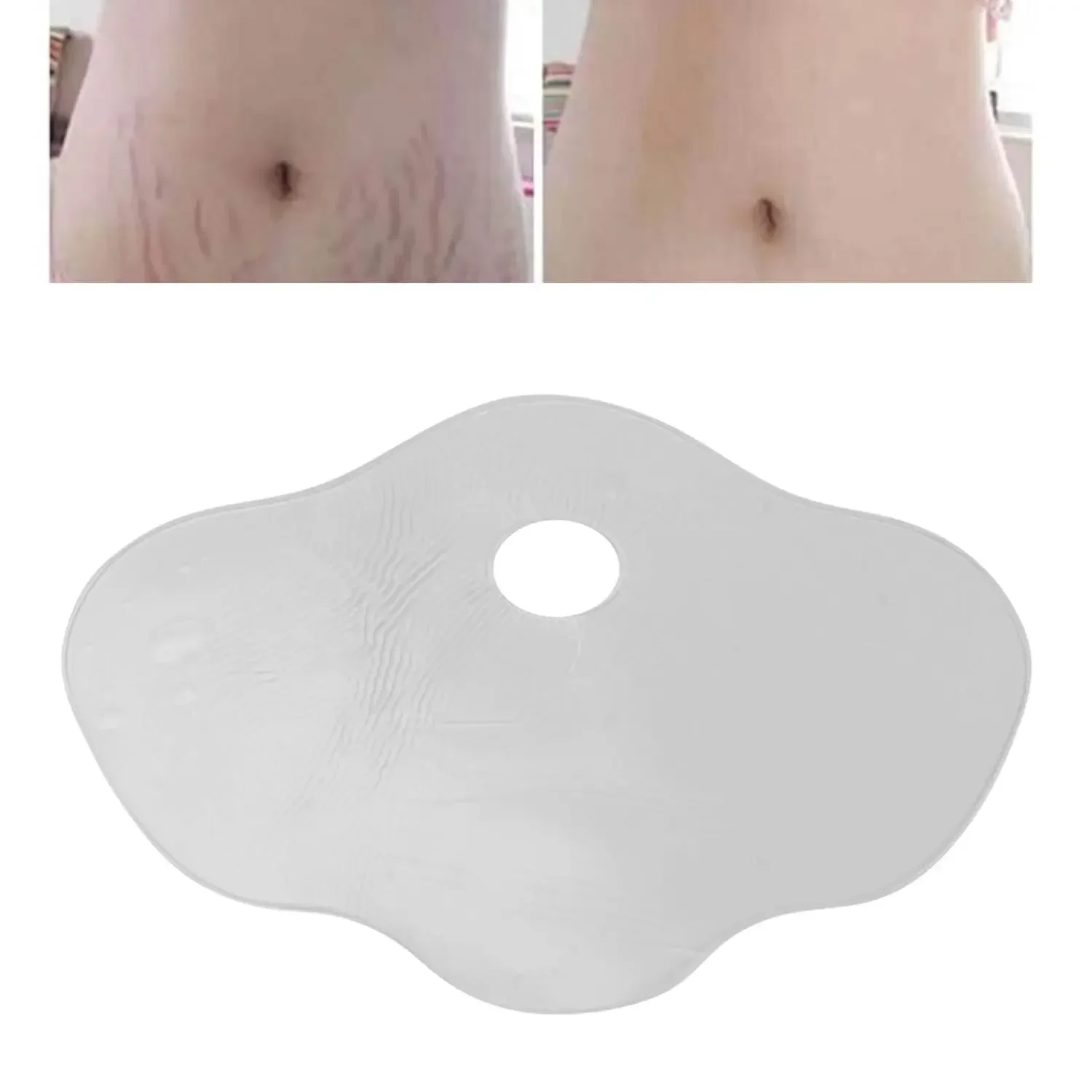 Belly Silicone Pad Anti Wrinkle Scar Stretch Marks Removal Sheets Reusable for Women Abdomen Belly Stomach Pads Stickers