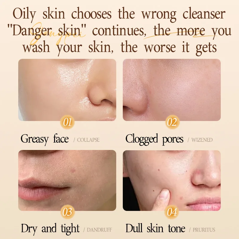 308G/500g Astragalus Sulfur Cleanser Deep Cleansing Hydrating Moisturizing Oil Control Facial Cleanser - Image 2