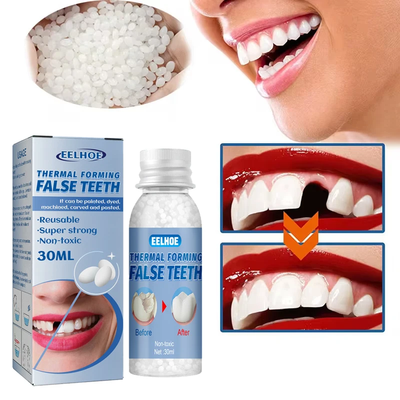 Resin Tooth Repair Teeth Gaps Filling Solid Glue Shapeable Temporary Teeth Repair False Teeth Glue Safety Dental Supplies Tools