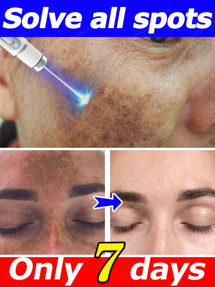 Highly effective repair facial dark spot