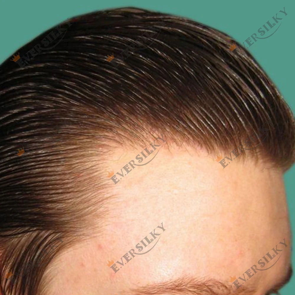 

0,02 мм тонкая кожа, мужской протез, девственные человеческие волосы, Vloop, мужская система замены волос, блондинка, коричневый, черный, серый, парики без узлов