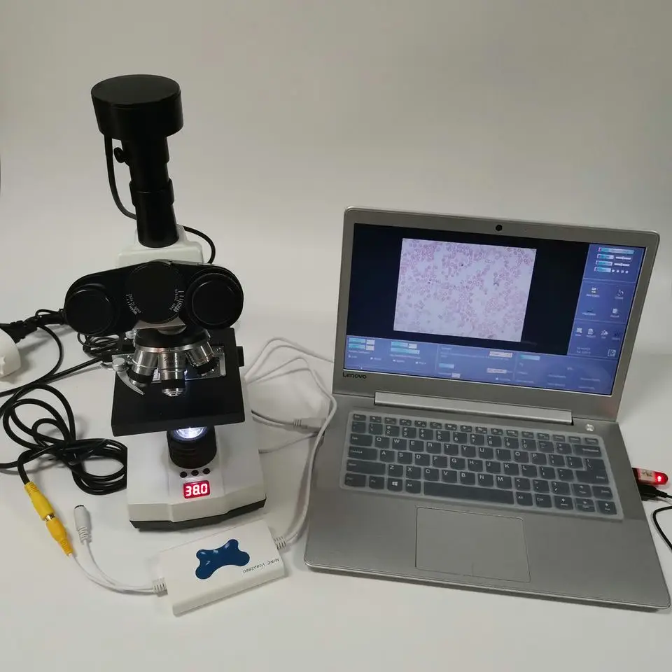 

Hospital Lab Portable Automatic Sperm Test Equipment Laptop Sperm Count Quality Analyzer Microscope PLS-MY-B041A-3