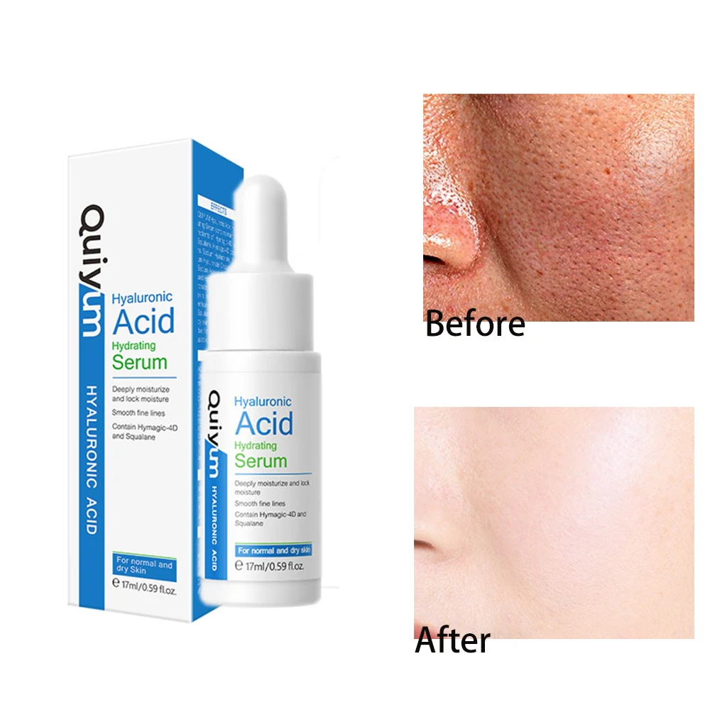 Acido Hiauluronico Para La Cara Suero Facial Face Serum Anti Aging Lines And Wrinkles Melasma Hidratante Moisturizer Skin Care