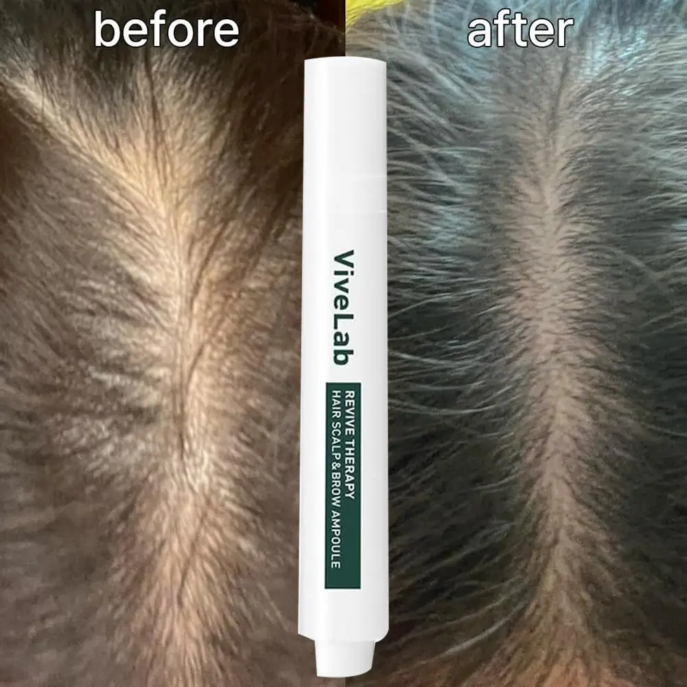 

15ml Scalp and Hair Serum for Thinning Hair Anti Hair-loss Essence Oil Health Nourishing Split Ends Dry Types