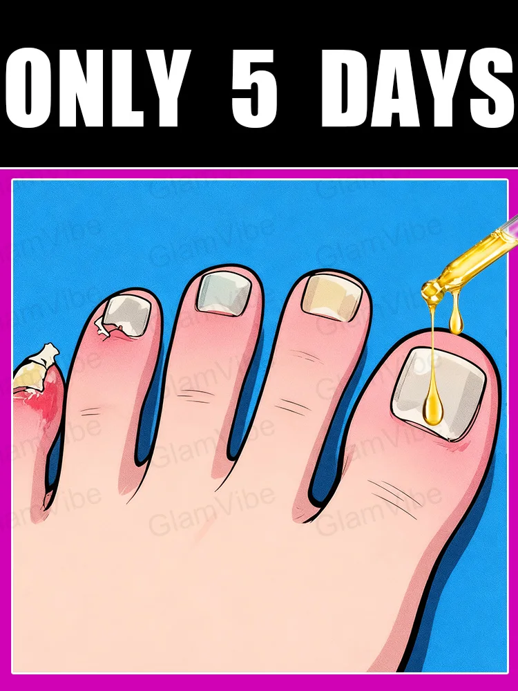 

2025 New Upgrade Blue Laser Solve Wart Tool