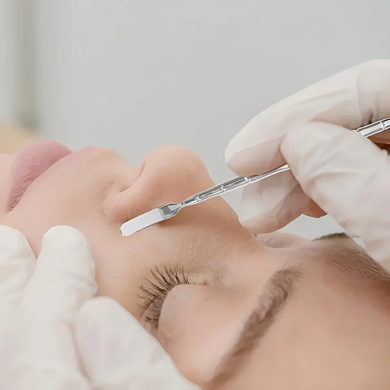 3-delig mee-eterverwijderaar met twee uiteinden - hypoallergeen, ideaal voor alle huidtypes