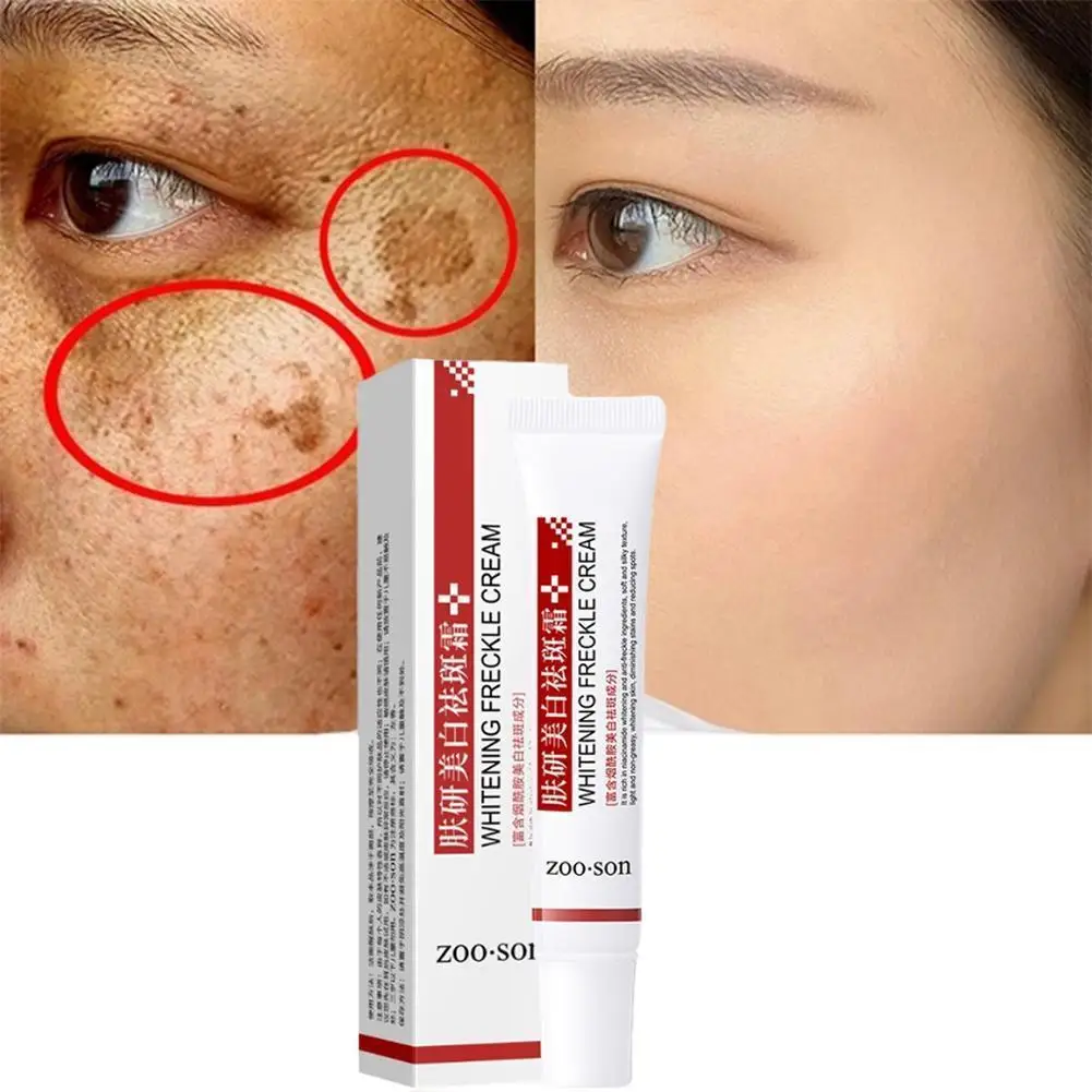 Whitening Freckle Cream Verwijder donkere vlekken Anti Freckle Face Creams Niacinamide Fade Pigmentatie Melasma Helder Huidverzo