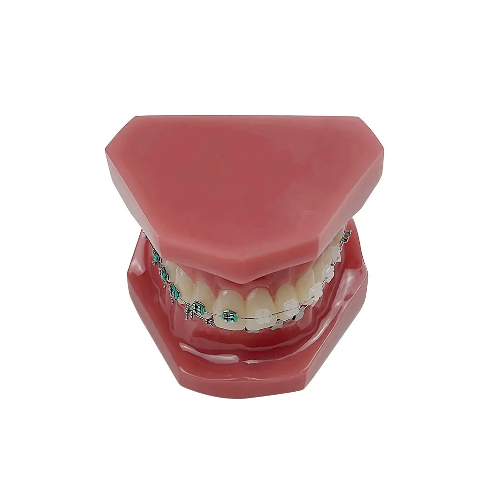 Normal Dental Orthodontic Teeth Model With Brace Half Metal Half Ceramic Standard Teaching Model Dental Teeth Model For Studying