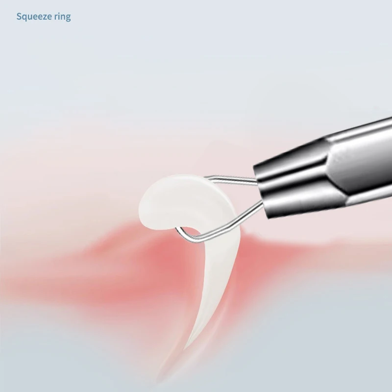 0.02mm Punta dell'ago ultra fine Punti neri Comedone Acne Estrattore di brufoli Aghi in acciaio inossidabile Strumenti per la cura della pelle del viso