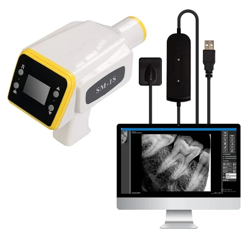 Portable Digital  Machine for 0.3s Fast Imaging, Human/Animal Use, CE