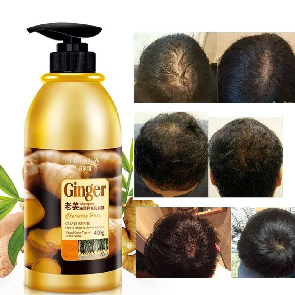 Champú para el cabello de jengibre a base de hierbas, crecimiento del cabello, sin Control de aceite de silicona, anticaspa, limpieza de picazón, tratamiento profesional para el cabello, 400ml