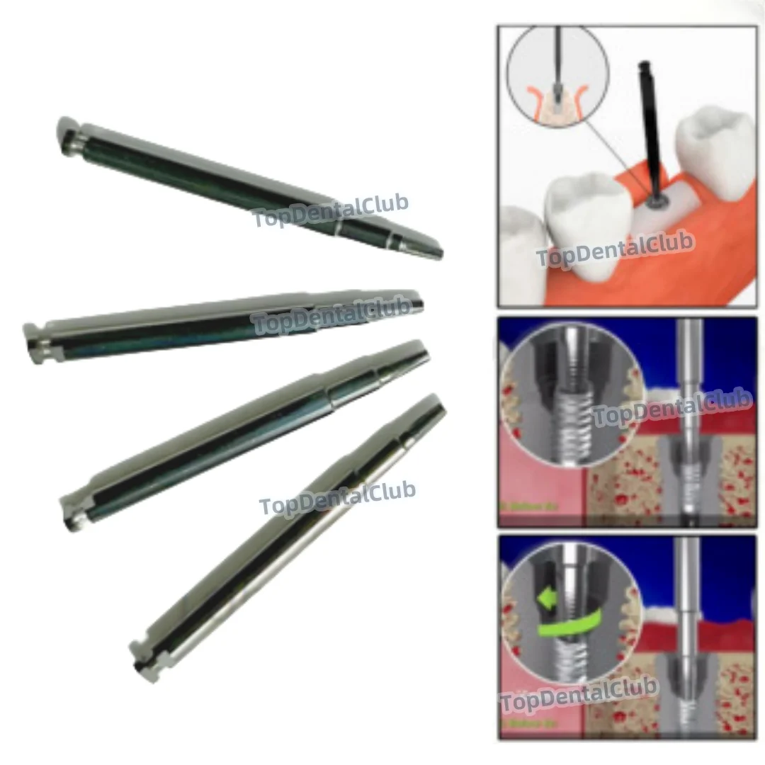 

Dental Screw Implant Fixture Fractured Broken Screws Removal SOS Remove Tap Extractor φ0.8mm/1.3mm