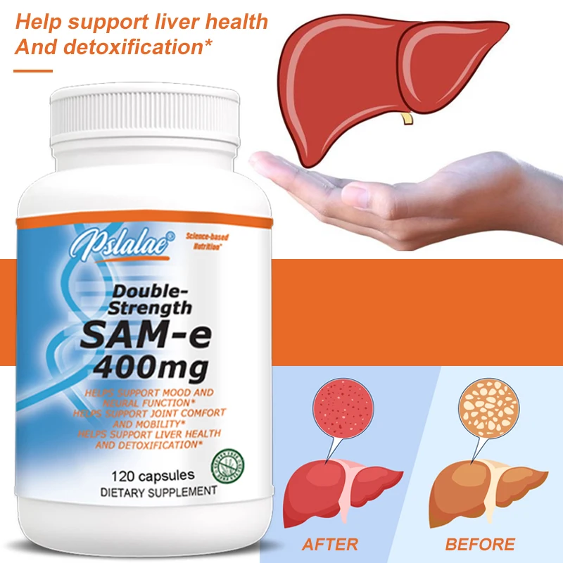 

Добавка для суставов Sam-E 400 мг — поддерживает здоровье суставов, для здоровья костей и хряща.