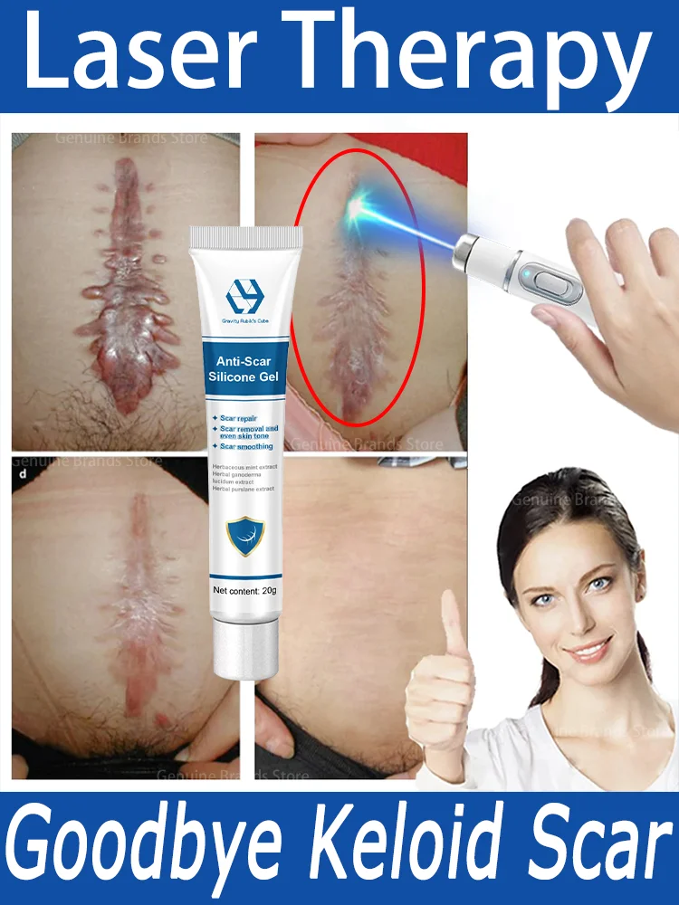 Effective Scar LASER PEN，For all kinds of scars，Burn，Surgical scar，Various scars age