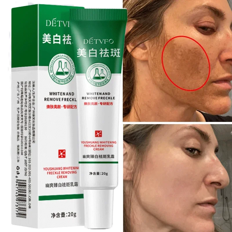 Freckle Whitening Cream Black Dots Melasma Remover Anti Brown Stain Lighten Pigmentation Moisturizing Korean Skin Care Products